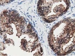SSSCA1 Mouse anti-Human, Clone: OTI2F5, lyophilized, TrueMAB 100 &mu;g;