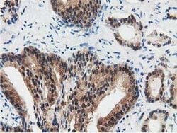 SSSCA1 Mouse anti-Human, Clone: OTI2F5, lyophilized, TrueMAB 100 &mu;g;