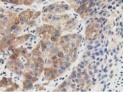 SSSCA1 Mouse anti-Human, Clone: OTI2F5, lyophilized, TrueMAB 100 &mu;g;