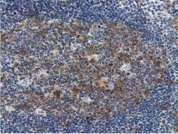 SSSCA1 Mouse anti-Human, Clone: OTI2F5, lyophilized, TrueMAB 100 &mu;g;