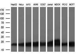 SSSCA1 Mouse anti-Human, Clone: OTI2F5, lyophilized, TrueMAB 100 &mu;g;