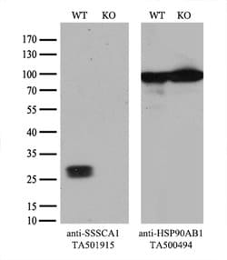 SSSCA1 Mouse anti-Human, Clone: OTI2F5, lyophilized, TrueMAB 100 &mu;g;