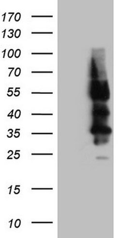 SSTR4 Monoclonal Antibody (OTI2F11), TrueMAB , OriGene:Antibodies:Primary