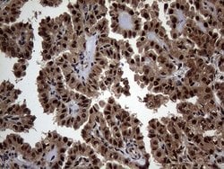 SSU72 Mouse anti-Human, Clone: OTI5A1, lyophilized, TrueMAB 100 &mu;g;