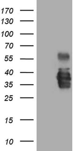 SSU72 Monoclonal Antibody (OTI4B3), TrueMAB , OriGene:Antibodies:Primary