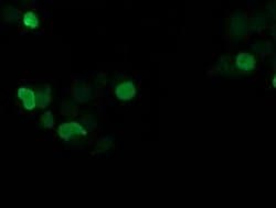 SSX1 Monoclonal Antibody (OTI1E10), TrueMAB , OriGene 100 &mu;L; Unconjugated:Antibodies,