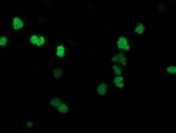 SSX1 Monoclonal Antibody (OTI2G5), TrueMAB , OriGene 100 &mu;L; Unconjugated:Antibodies,
