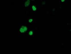 SSX1 Monoclonal Antibody (OTI2D12), TrueMAB , OriGene:Antibodies:Primary