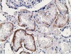 SSX1 Monoclonal Antibody (OTI1E10), TrueMAB , OriGene 100 &mu;L; Unconjugated:Antibodies,