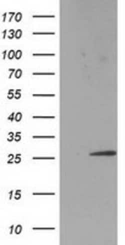 SSX1 Mouse anti-Human, Clone: OTI1D10, lyophilized, TrueMAB 100 &mu;g;