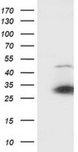 SSX1 Monoclonal Antibody (OTI2G5), TrueMAB , OriGene 100 &mu;L; Unconjugated:Antibodies,