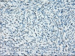 SSX2 Mouse anti-Human, Clone: OTI4A11, lyophilized, TrueMAB 100 &mu;g;