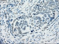 SSX2 Mouse anti-Human, Clone: OTI4A11, lyophilized, TrueMAB 100 &mu;g;
