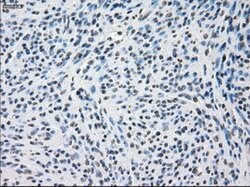 SSX2 Mouse anti-Human, Clone: OTI4A11, lyophilized, TrueMAB 100 &mu;g;
