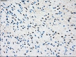 SSX2 Mouse anti-Human, Clone: OTI4A11, lyophilized, TrueMAB 100 &mu;g;