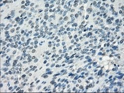 SSX2 Mouse anti-Human, Clone: OTI4A11, lyophilized, TrueMAB 100 &mu;g;