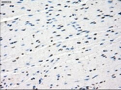 SSX2 Mouse anti-Human, Clone: OTI4A11, lyophilized, TrueMAB 100 &mu;g;