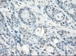 SSX2 Mouse anti-Human, Clone: OTI4A11, lyophilized, TrueMAB 100 &mu;g;