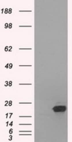 SSX2 Mouse anti-Human, Clone: OTI4A11, lyophilized, TrueMAB 100 &mu;g;