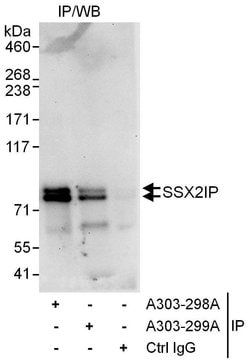 SSX2IP Rabbit anti-Human, Polyclonal, Bethyl Laboratories 100 &mu;l; Unlabeled:Antibodies,