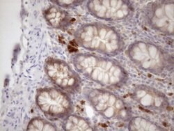 SSX2IP Monoclonal Antibody (OTI5C3), TrueMAB , OriGene 100 &mu;L; Unconjugated:Antibodies,