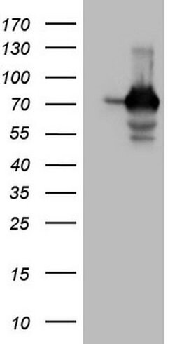 SSX2IP Monoclonal Antibody (OTI5C3), TrueMAB , OriGene:Antibodies:Primary