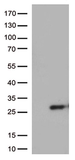 SSX4B Monoclonal Antibody (OTI2E10), TrueMAB , OriGene:Antibodies:Primary