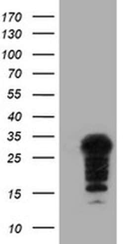 SSX5 Monoclonal Antibody (OTI3G6), TrueMAB , OriGene 100 &mu;L; Unconjugated:Antibodies,