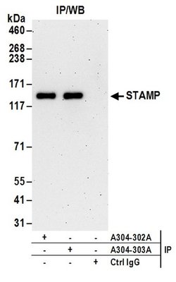 STAMP Rabbit anti-Human, Polyclonal, Bethyl Laboratories 100 &mu;L; Unconjugated:Antibodies,