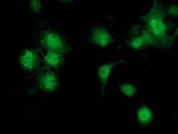 STAT4 Monoclonal Antibody (OTI1G9), TrueMAB , OriGene 100 μL; Unconjugated:Antibodies,