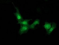 STAT4 Monoclonal Antibody (OTI2G5), TrueMAB , OriGene:Antibodies:Primary