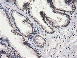STAT5A Mouse anti-Human, Clone: OTI11A9, lyophilized, TrueMAB 100 &mu;g;