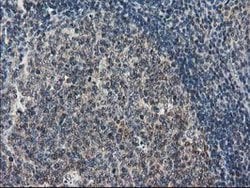 STAT5A Mouse anti-Human, Clone: OTI11A9, lyophilized, TrueMAB 100 &mu;g;