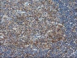 STAT5A Mouse anti-Human, Clone: OTI9A5, TrueMAB , Origene 30 &mu;L | Buy Online | Origene Technologies | Fisher Scientific