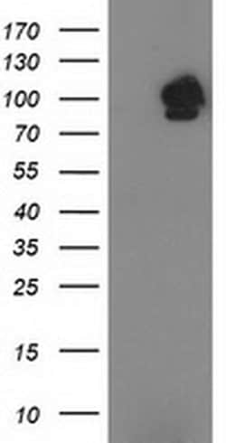 STAT5A Monoclonal Antibody (OTI10H1), TrueMAB , OriGene:Anticuerpos:Anticuerpos