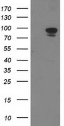 STAT5A Mouse anti-Human, Clone: OTI11A9, lyophilized, TrueMAB 100 &mu;g;