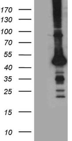 STBD1 Monoclonal Antibody (OTI6E9), TrueMAB , OriGene:Antibodies:Primary