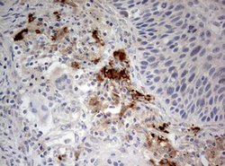 STK11 Mouse anti-Human, Clone: OTI0A3, lyophilized, TrueMAB 100 &mu;g;