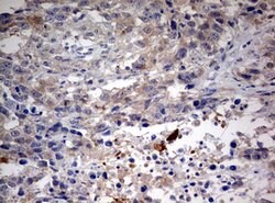 STK11 Mouse anti-Human, Clone: OTI0A3, lyophilized, TrueMAB 100 &mu;g;