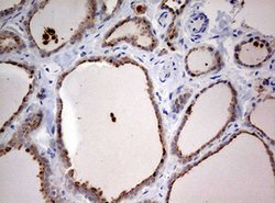 STK11 Mouse anti-Human, Clone: OTI0A3, lyophilized, TrueMAB 100 &mu;g;