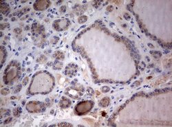 STK11 Mouse anti-Human, Clone: OTI0A3, lyophilized, TrueMAB 100 &mu;g;