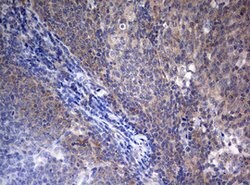 STK11 Mouse anti-Human, Clone: OTI0A3, lyophilized, TrueMAB 100 &mu;g;