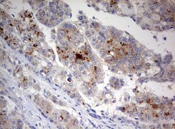 STK11 Mouse anti-Human, Clone: OTI0A3, lyophilized, TrueMAB 100 &mu;g;