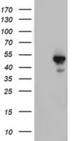 STK11 Mouse anti-Human, Clone: OTI1F10, lyophilized, TrueMAB 100 &mu;g;