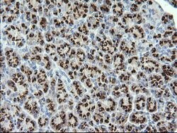 STK38L Mouse anti-Human, Clone: OTI3E10, lyophilized, TrueMAB 100 &mu;g;