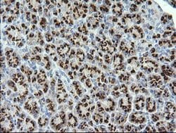 STK38L Monoclonal Antibody (OTI3E10), TrueMAB , OriGene 30 &mu;L; Unconjugated:Antibodies,