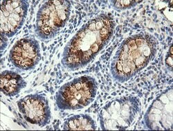 STK38L Mouse anti-Human, Clone: OTI3E10, lyophilized, TrueMAB 100 &mu;g;