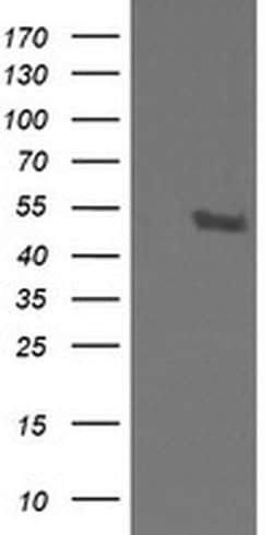 STK38L Mouse anti-Canine, Human, Mouse, Rat, Clone: OTI4D8, liquid, TrueMAB