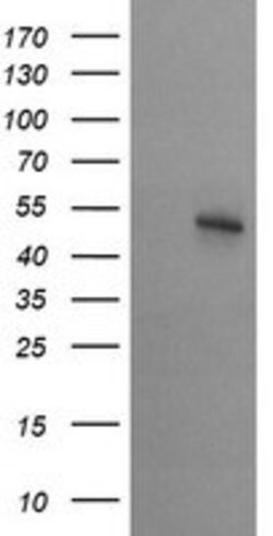 STK38L Mouse anti-Human, Clone: OTI3E10, lyophilized, TrueMAB 100 &mu;g;