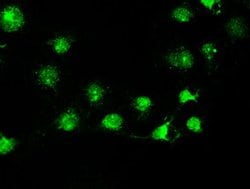 STK39 Mouse anti-Human, Clone: OTI4H3, lyophilized, TrueMAB 100 &mu;g;